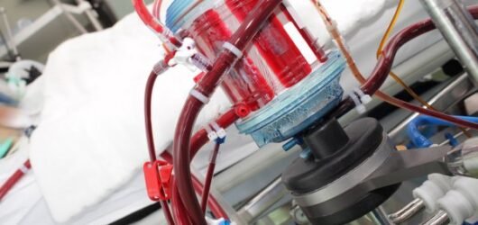 💊 Lévosimendan : un traitement prometteur… mais sans bénéfice clair dans les cas sévères