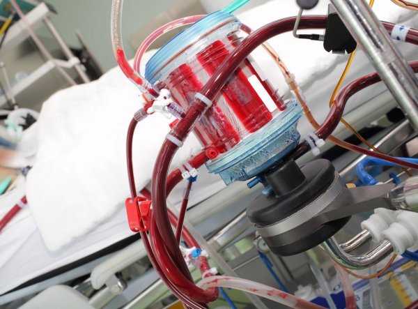 💊 Lévosimendan : un traitement prometteur… mais sans bénéfice clair dans les cas sévères